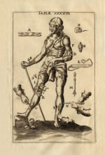 Arcenal-Lrsquo-de-chirurgie-de-Jean-Scultet-medecin-et-chirurgien-de-la-Republique-drsquoUlmes.-Nouvellement-traduit-en-francais-par-un-celebre-medecin.-Augmente-de-plusieurs-reflexions-sur-la-Theorie-et-de-quantite-de-remedes-convenables-a-chaque-maladie-avec-un-Traite-des-accouchemens-naturels-et-contre-nature-la-Description-de-deux-monstres-humains-et-une-dissertation-sur-un-autre-Monstre-ne-a-Lyon-le-28-de-septembre-1702.-Enrichi-de-50-figures-en-taille-douce-ou-sont-representes-tous-les-instrumens-de-chirurgie-anciens-et-modernes-avec-la-maniere-de-faire-les-operations